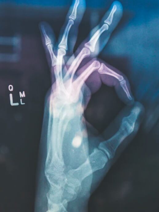 Babel Products Solutions EOS. Radiology of a hand making the OK symbol